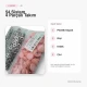 15 mm / 0.591 in Light Pink Plastic-Capped Snap Fastener for garments, bags, and home textiles